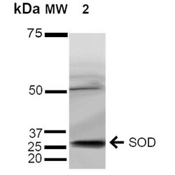 SOD3/EC-SOD Antibody, Novus Biologicals 100 &mu;g | Buy Online | Novus Biologicals | Fisher Scientific